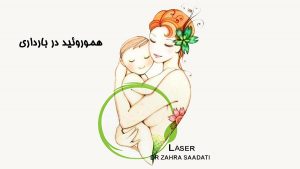 هموروئید در بارداری