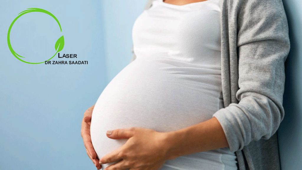 کیست مویی و بارداری