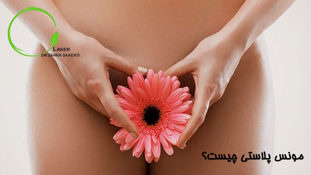مونس پلاستی