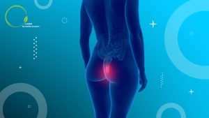 سرطان مقعد چیست؟ تشخیص و درمان