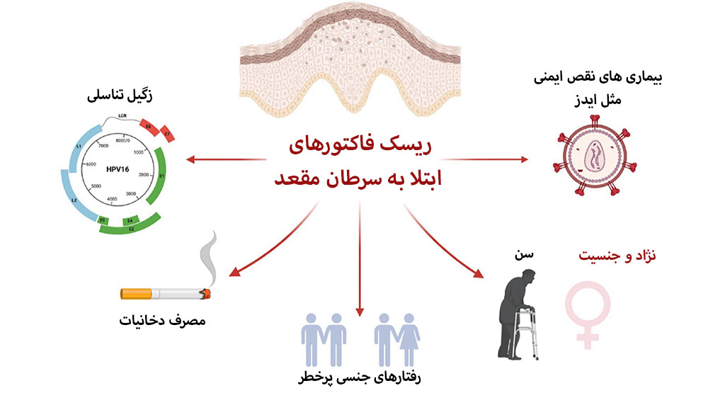 ریسک فاکتورهای ابتلا به سرطان مقعد که مربوط به بیماری های ویروسی دخانیات پارتنر متعدد سن و نژاد و جنس و ایدز و مصرف دخانیات می شود.