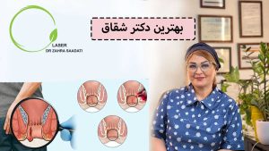 بهترین دکتر شقاق