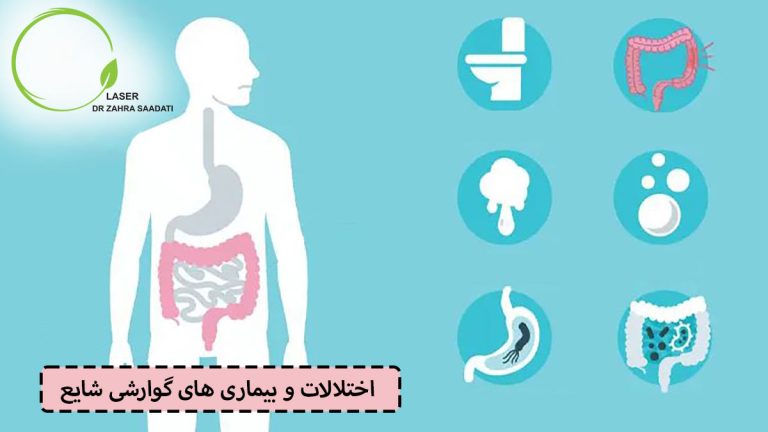 اختلالات و بیماری های گوارشی شایع