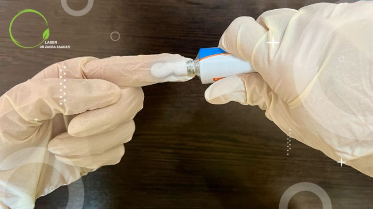 روش استفاده صحیح از پماد خونریزی بواسیر