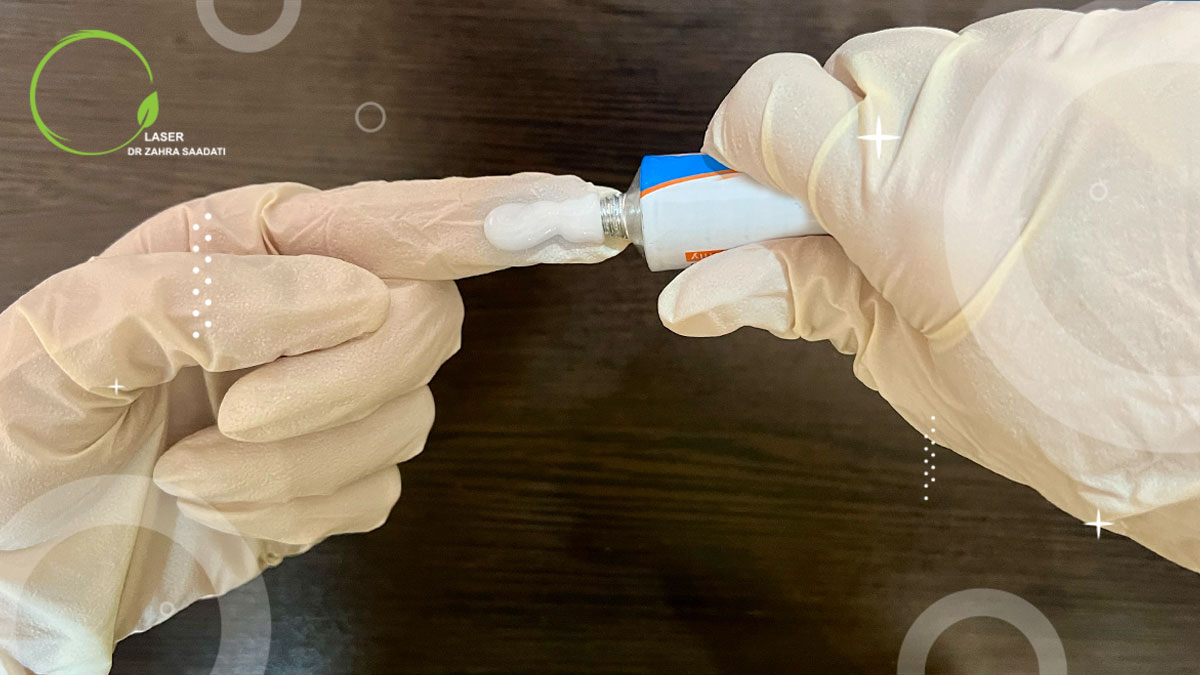 روش استفاده صحیح از پماد خونریزی بواسیر