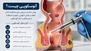 آنوسکوپی چیست و کاربردهای آن در تشخیص بیماری های مقعد