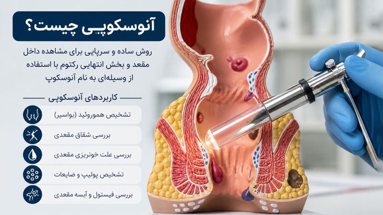 آنوسکوپی چیست و کاربردهای آن در تشخیص بیماری های مقعد