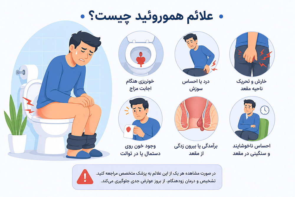 علائم هموروئید در یک نگاه
