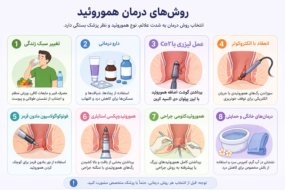 جدول روش های درمان هموروئید در ۸ روش مختلف
